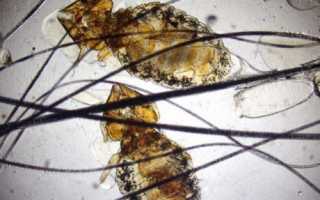 Какие болезни можно встретить у перепелов